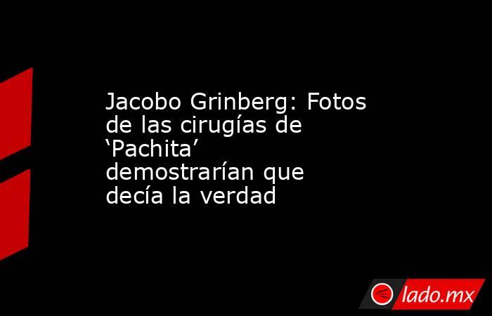 Jacobo Grinberg: Fotos de las cirugías de ‘Pachita’ demostrarían que decía la verdad. Noticias en tiempo real