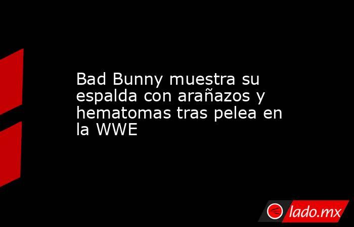 Bad Bunny muestra su espalda con arañazos y hematomas tras pelea en la WWE. Noticias en tiempo real