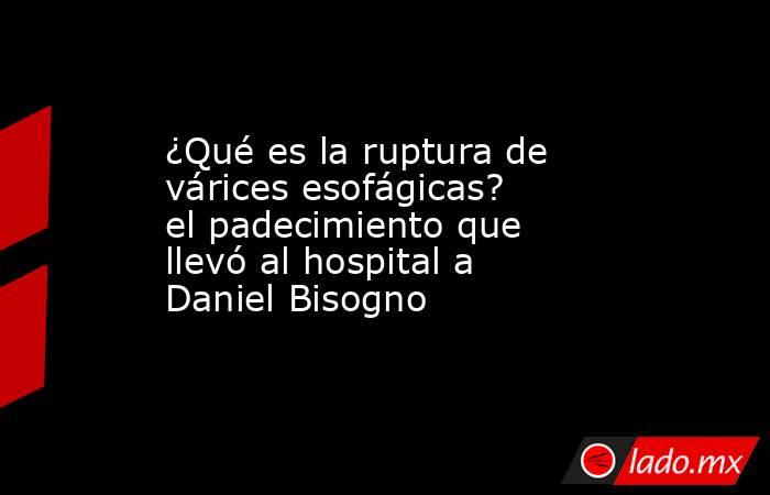 ¿Qué es la ruptura de várices esofágicas? el padecimiento que llevó al hospital a Daniel Bisogno. Noticias en tiempo real