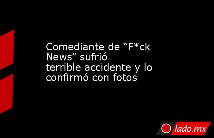 Comediante de “F*ck News” sufrió terrible accidente y lo confirmó con fotos. Noticias en tiempo real
