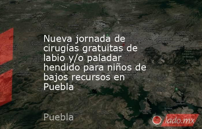 Nueva jornada de cirugías gratuitas de labio y/o paladar hendido para niños de bajos recursos en Puebla. Noticias en tiempo real