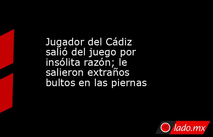 Jugador del Cádiz salió del juego por insólita razón; le salieron extraños bultos en las piernas. Noticias en tiempo real