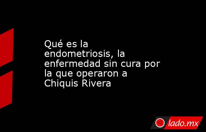 Qué es la endometriosis, la enfermedad sin cura por la que operaron a Chiquis Rivera. Noticias en tiempo real