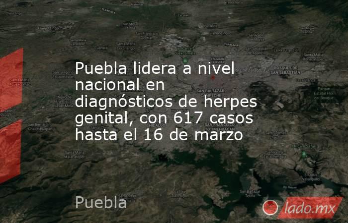 Puebla lidera a nivel nacional en diagnósticos de herpes genital, con 617 casos hasta el 16 de marzo. Noticias en tiempo real