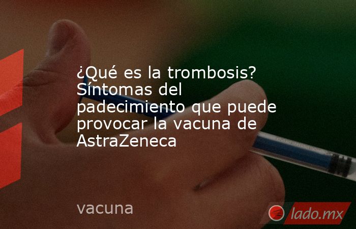 ¿Qué es la trombosis? Síntomas del padecimiento que puede provocar la vacuna de AstraZeneca. Noticias en tiempo real