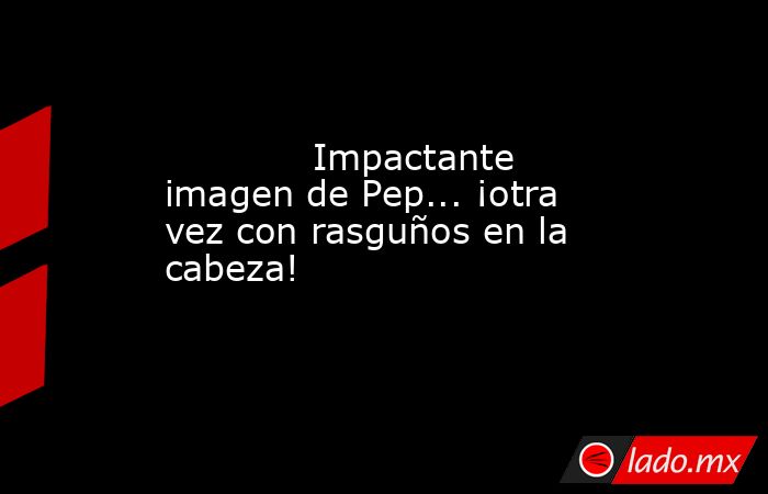                                                             Impactante imagen de Pep... ¡otra vez con rasguños en la cabeza!                                                        . Noticias en tiempo real