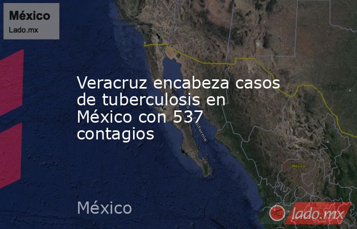 Veracruz encabeza casos de tuberculosis en México con 537 contagios. Noticias en tiempo real