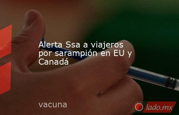 Alerta Ssa a viajeros por sarampión en EU y Canadá. Noticias en tiempo real