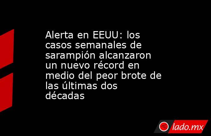 Alerta en EEUU: los casos semanales de sarampión alcanzaron un nuevo récord en medio del peor brote de las últimas dos décadas. Noticias en tiempo real