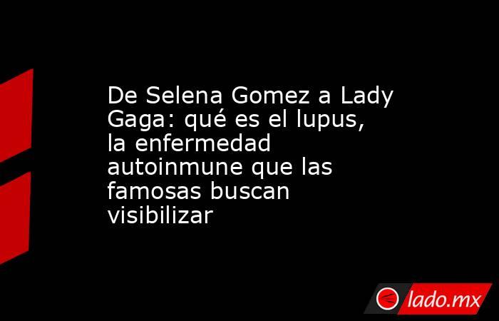 De Selena Gomez a Lady Gaga: qué es el lupus, la enfermedad autoinmune que las famosas buscan visibilizar. Noticias en tiempo real