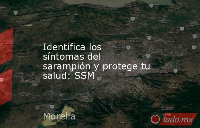 Identifica los síntomas del sarampión y protege tu salud: SSM. Noticias en tiempo real