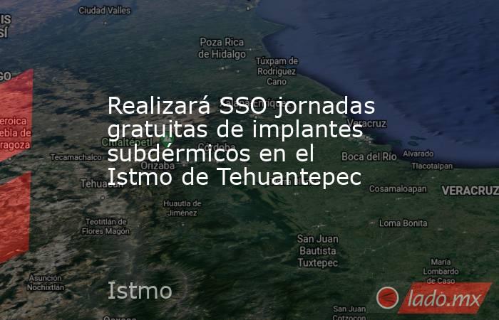 Realizará SSO jornadas gratuitas de implantes subdérmicos en el Istmo de Tehuantepec. Noticias en tiempo real