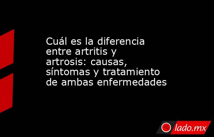 Cuál es la diferencia entre artritis y artrosis: causas, síntomas y tratamiento de ambas enfermedades. Noticias en tiempo real