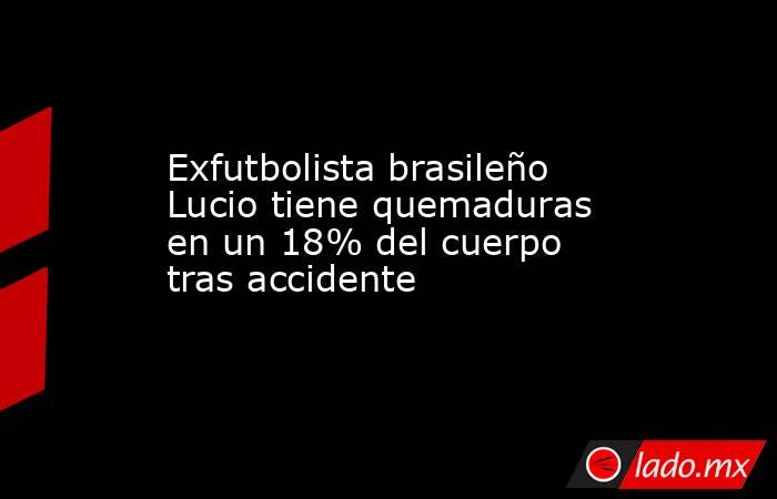 Exfutbolista brasileño Lucio tiene quemaduras en un 18% del cuerpo tras accidente. Noticias en tiempo real