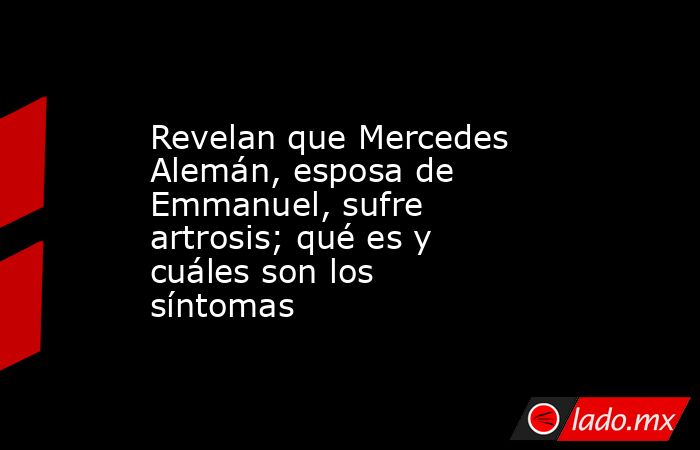 Revelan que Mercedes Alemán, esposa de Emmanuel, sufre artrosis; qué es y cuáles son los síntomas. Noticias en tiempo real