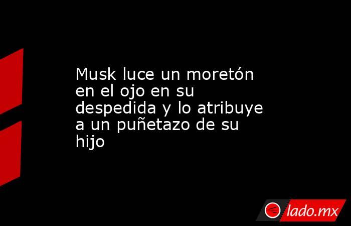 Musk luce un moretón en el ojo en su despedida y lo atribuye a un puñetazo de su hijo. Noticias en tiempo real