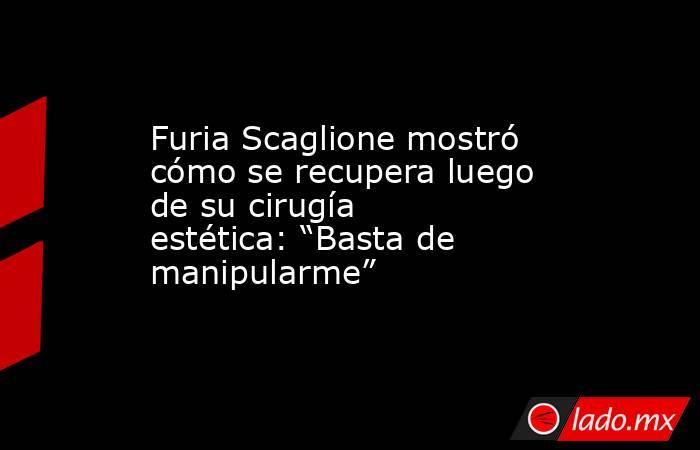 Furia Scaglione mostró cómo se recupera luego de su cirugía estética: “Basta de manipularme”. Noticias en tiempo real