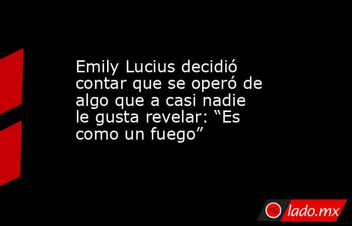 Emily Lucius decidió contar que se operó de algo que a casi nadie le gusta revelar: “Es como un fuego”. Noticias en tiempo real