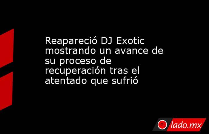 Reapareció DJ Exotic mostrando un avance de su proceso de recuperación tras el atentado que sufrió . Noticias en tiempo real