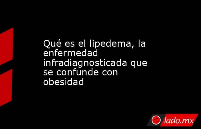 Qué es el lipedema, la enfermedad infradiagnosticada que se confunde con obesidad. Noticias en tiempo real