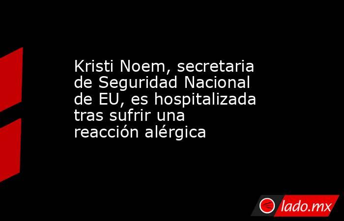 Kristi Noem, secretaria de Seguridad Nacional de EU, es hospitalizada tras sufrir una reacción alérgica. Noticias en tiempo real