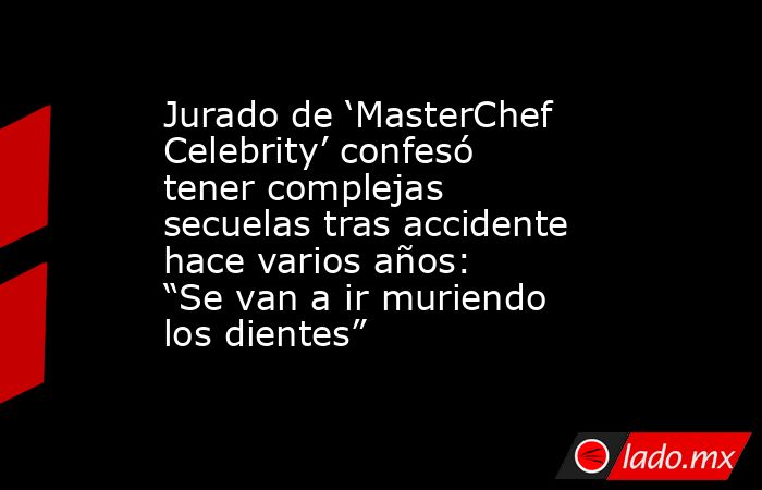 Jurado de ‘MasterChef Celebrity’ confesó tener complejas secuelas tras accidente hace varios años: “Se van a ir muriendo los dientes” . Noticias en tiempo real