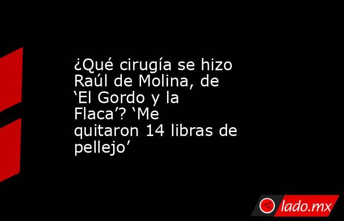 ¿Qué cirugía se hizo Raúl de Molina, de ‘El Gordo y la Flaca’? ‘Me quitaron 14 libras de pellejo’. Noticias en tiempo real