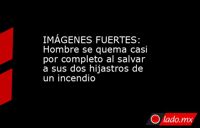 IMÁGENES FUERTES: Hombre se quema casi por completo al salvar a sus dos hijastros de un incendio. Noticias en tiempo real