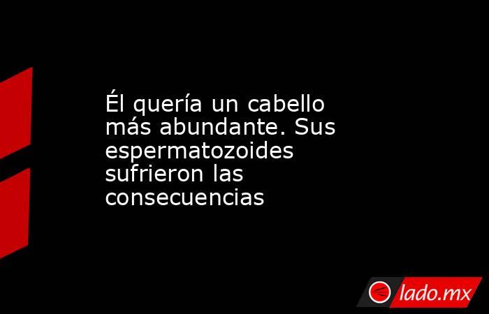 Él quería un cabello más abundante. Sus espermatozoides sufrieron las consecuencias. Noticias en tiempo real