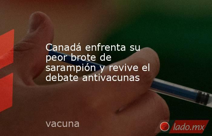 Canadá enfrenta su peor brote de sarampión y revive el debate antivacunas. Noticias en tiempo real