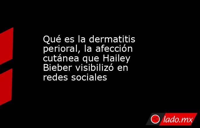 Qué es la dermatitis perioral, la afección cutánea que Hailey Bieber visibilizó en redes sociales. Noticias en tiempo real