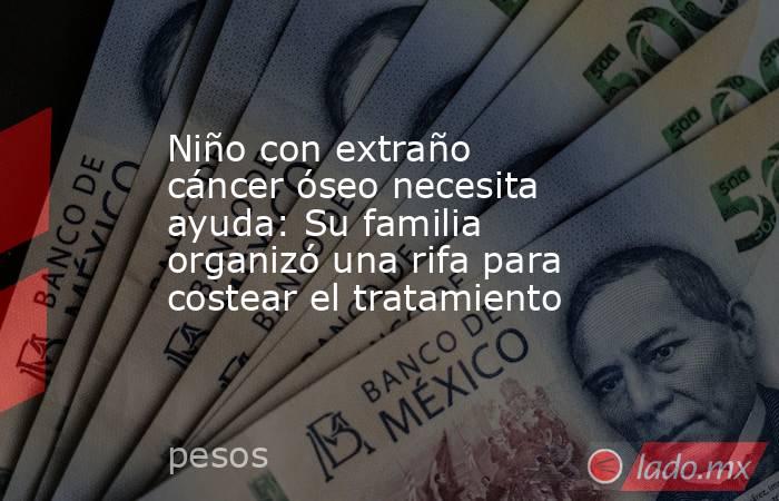 Niño con extraño cáncer óseo necesita ayuda: Su familia organizó una rifa para costear el tratamiento. Noticias en tiempo real