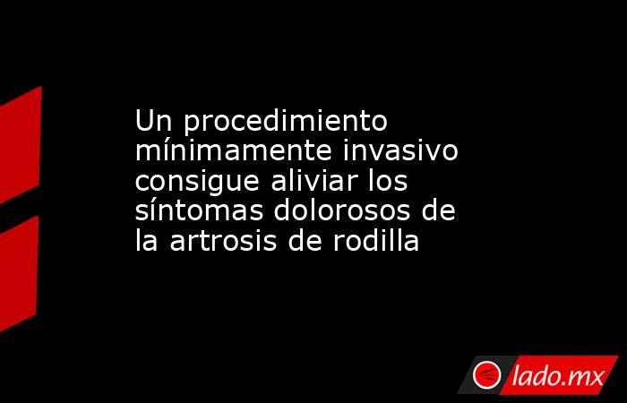 Un procedimiento mínimamente invasivo consigue aliviar los síntomas dolorosos de la artrosis de rodilla. Noticias en tiempo real