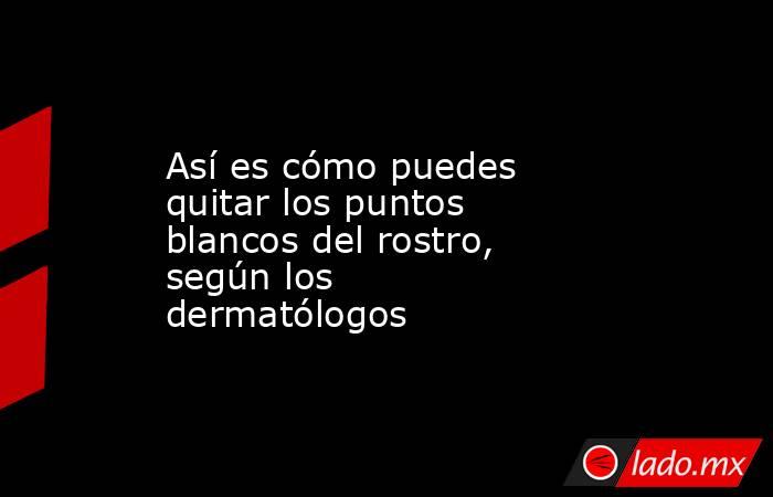 Así es cómo puedes quitar los puntos blancos del rostro, según los dermatólogos. Noticias en tiempo real