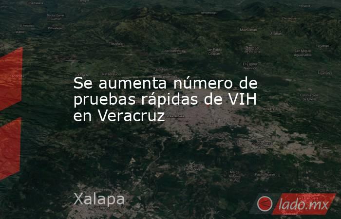 Se aumenta número de pruebas rápidas de VIH en Veracruz. Noticias en tiempo real