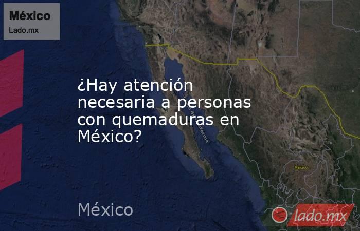 ¿Hay atención necesaria a personas con quemaduras en México?. Noticias en tiempo real