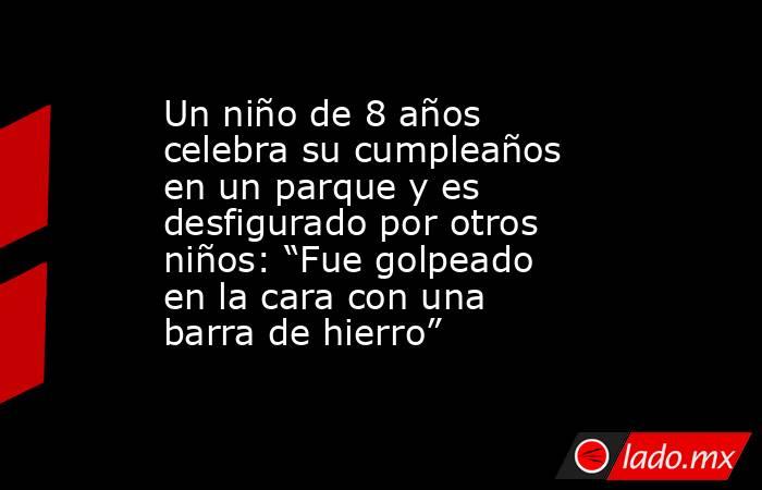Un niño de 8 años celebra su cumpleaños en un parque y es desfigurado por otros niños: “Fue golpeado en la cara con una barra de hierro” . Noticias en tiempo real