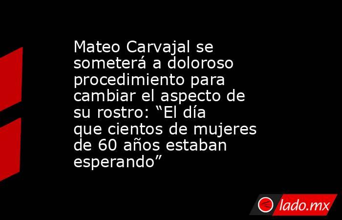 Mateo Carvajal se someterá a doloroso procedimiento para cambiar el aspecto de su rostro: “El día que cientos de mujeres de 60 años estaban esperando”. Noticias en tiempo real