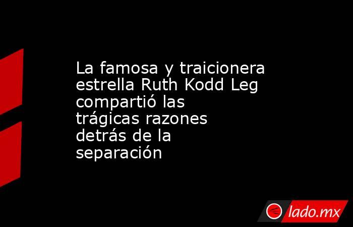 La famosa y traicionera estrella Ruth Kodd Leg compartió las trágicas razones detrás de la separación. Noticias en tiempo real