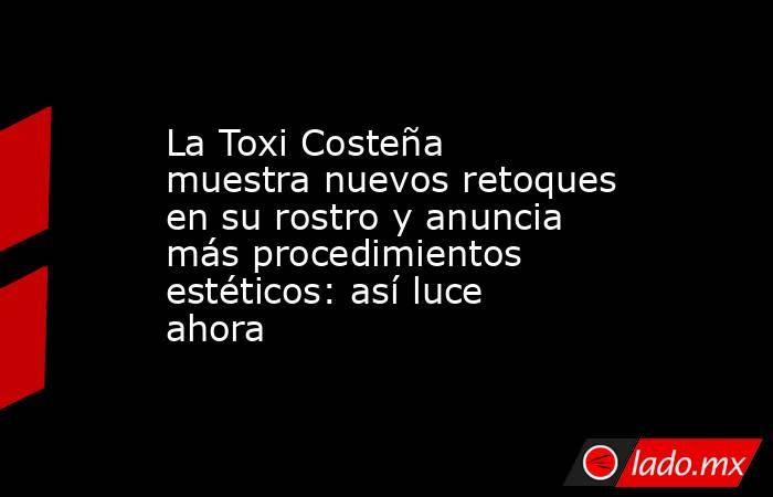 La Toxi Costeña muestra nuevos retoques en su rostro y anuncia más procedimientos estéticos: así luce ahora. Noticias en tiempo real