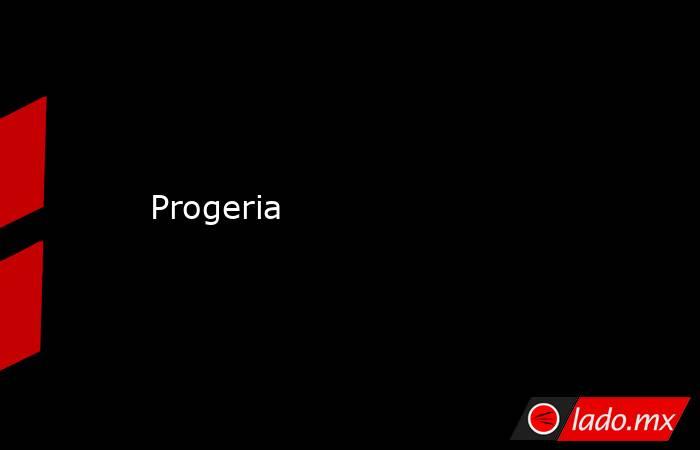 Progeria. Noticias en tiempo real