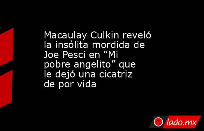 Macaulay Culkin reveló la insólita mordida de Joe Pesci en “Mi pobre angelito” que le dejó una cicatriz de por vida . Noticias en tiempo real