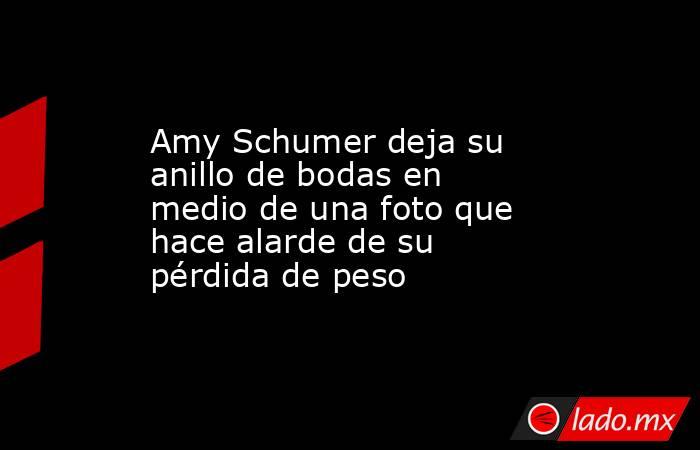 Amy Schumer deja su anillo de bodas en medio de una foto que hace alarde de su pérdida de peso. Noticias en tiempo real
