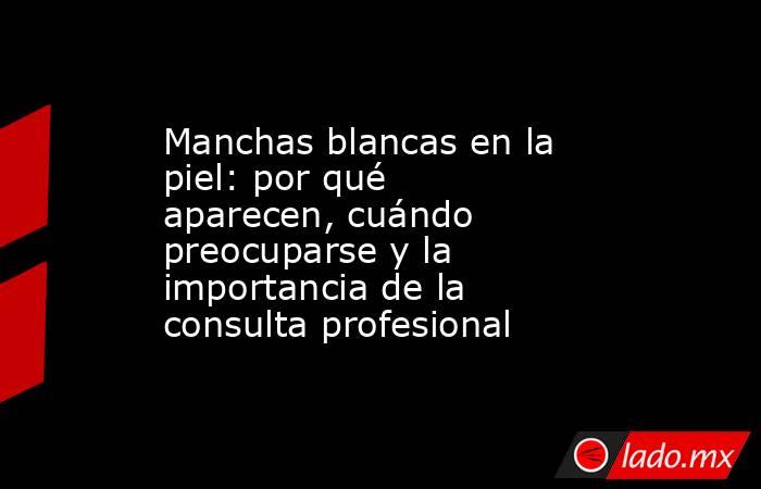 Manchas blancas en la piel: por qué aparecen, cuándo preocuparse y la importancia de la consulta profesional. Noticias en tiempo real