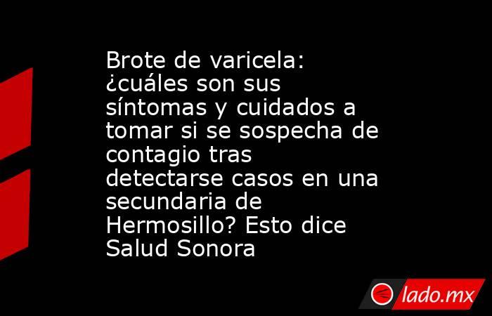 Brote de varicela: ¿cuáles son sus síntomas y cuidados a tomar si se sospecha de contagio tras detectarse casos en una secundaria de Hermosillo? Esto dice Salud Sonora. Noticias en tiempo real