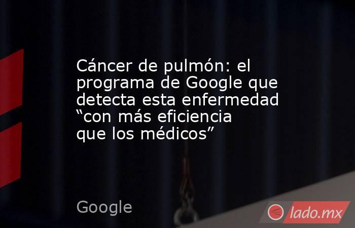 Cáncer de pulmón: el programa de Google que detecta esta enfermedad “con más eficiencia que los médicos”. Noticias en tiempo real