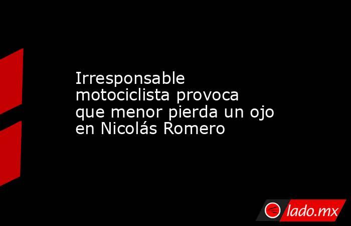 Irresponsable motociclista provoca que menor pierda un ojo en Nicolás Romero. Noticias en tiempo real