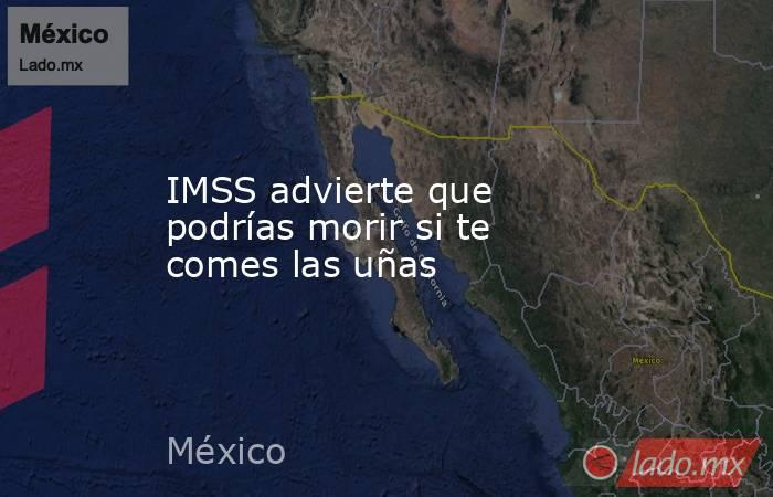 IMSS advierte que podrías morir si te comes las uñas. Noticias en tiempo real