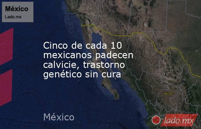 Cinco de cada 10 mexicanos padecen calvicie, trastorno genético sin cura. Noticias en tiempo real