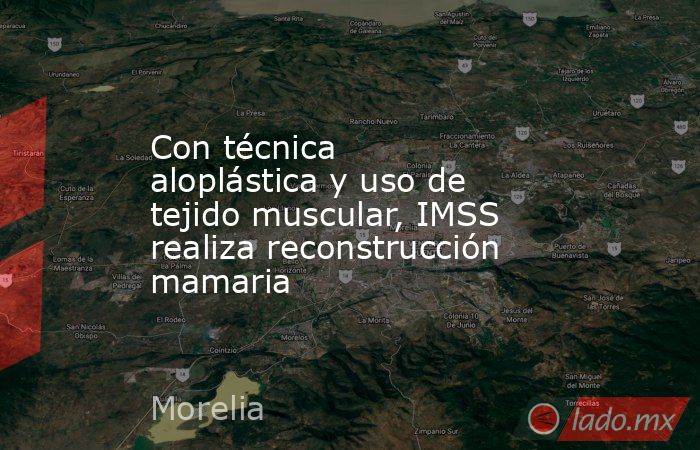 Con técnica aloplástica y uso de tejido muscular, IMSS realiza reconstrucción mamaria. Noticias en tiempo real